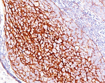IHC testing of human tonsil stained with CD35 antibody (E11). Note cell membrane staining.