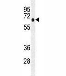 AMPK alpha Antibody