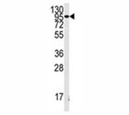 Fibroblast growth factor receptor 1 Antibody (FGFR1)