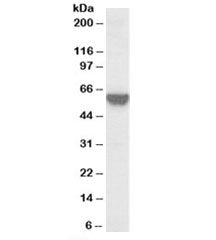 Western blot testing of A431 lysate with TOM1L2 antibody at 0.03ug/ml. Predicted molecular weight: ~