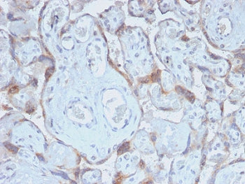 TIMP2 Antibody