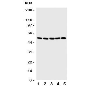 Western blot testing of SMAD5 antibody and Lane 1: human K562; 2: (h) Jurkat; 3: rat PC-12; 4: (h) H