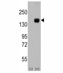 Western blot analysis of ASK1 antibody and 293 cell lysate (2 ug/lane) either nontransfected (Lane 1