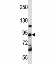 UBF Antibody (UBF1)