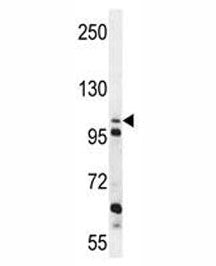 ZGRF1 Antibody