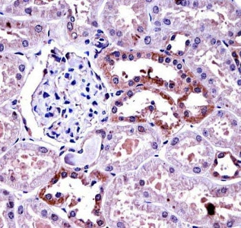 M-CSF Antibody / Macrophage Colony Stimulating Factor 1 / CSF1