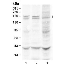 Western blot testing of 1) rat liver, 2) mouse liver and 3) human HeLa lysate with Thrombospondin an