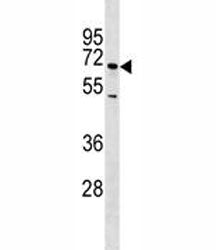 E-Selectin Antibody