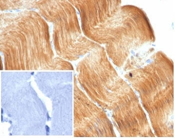 IHC staining of FFPE human skeletal muscle tissue with recombinant Alpha Actinin 2 antibody (clone A