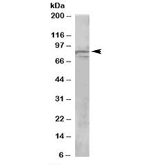OSBPL11 Antibody