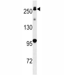 PARK8 Antibody (LRRK2)