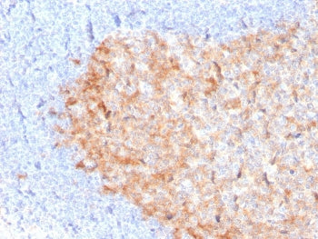 IHC staining of FFPE human tonsil with CD86 antibody (clone C86/3713). HIER: boil tissue sections in