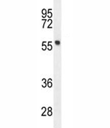 FEZF1 Antibody