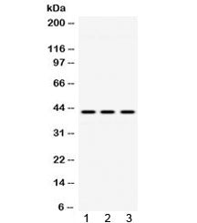 Western blot testing of 1) rat lung, 2) mouse brain and 3) human HeLa lysate with ACAA2 antibody at 