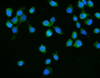 Immunofluorescent staining of FFPE human MCF7 cells with Dicer antibody (green) and DAPI nuclear sta