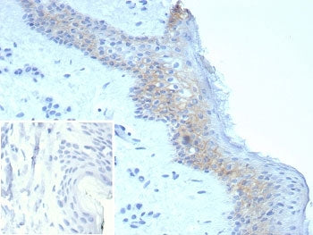 IHC staining of FFPE human skin tissue with Desmoglein 3 antibody (clone DSG3/8251R). Inset: PBS use