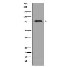 PKC beta 2 Antibody / PRKCB2
