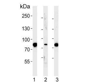EHHADH Antibody / L-bifunctional protein / LBP