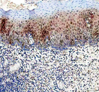 DUT Antibody / Deoxyuridine triphosphatase, 100ug