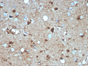 IHC staining of FFPE human brain tissue with S100B antibody (clone S100B/4139). HIER: boil tissue se