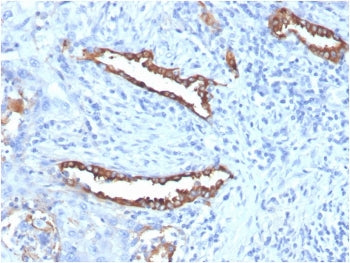 IHC staining of FFPE human lung tissue with recombinant Surfactant Protein D antibody (clone SFTPD/7