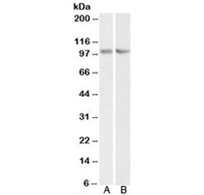 TRIM71 Antibody