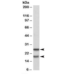 Western blot testing of PBMC lysate with SNAP23 antibody at 0.2ug/ml. Expected molecular weight: ~23