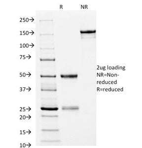 SDS-PAGE Analysis of Purified, BSA-Free HLA-DRB1 Antibody (clone L243). Confirmation of Integrity an