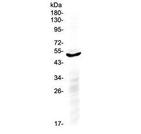 Western blot testing of human A549 cell lysate with IL6R antibody at 0.5ug/ml. Predicted molecular w
