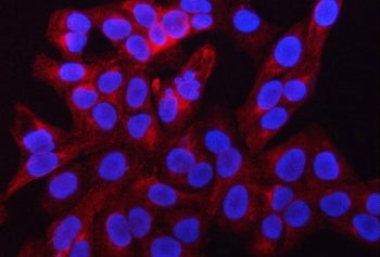 Immunofluorescent staining of FFPE human U-2 OS cells with RAB39A/B antibody (red) and DAPI nuclear 