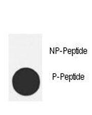 p-MDM2 Antibody (pT218)