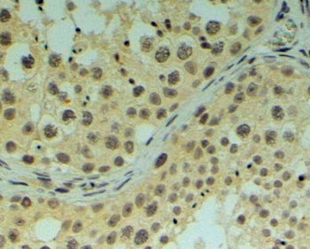 REV1 Antibody