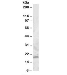 Western blot testing of peripheral blood mononucleocyte lysate with RGS13 antibody at 0.5ug/ml. Pred