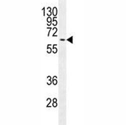 MAPK15 Antibody, 0.4ml