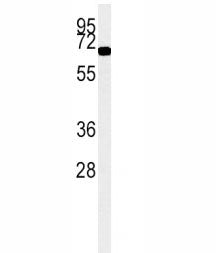 ACOX1 Antibody / Peroxisomal acyl-coenzyme A oxidase 1, 0.08ml