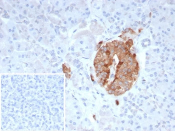Collagen IV Antibody / COL4A3