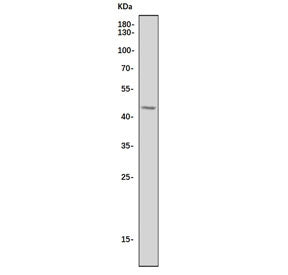 Western blot testing of human Jurkat cell lysate with CCR5 antibody. Predicted molecular weight ~41 