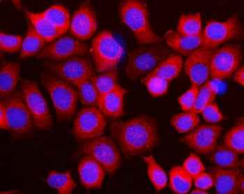 RPL10 Antibody