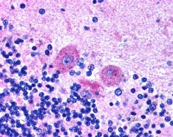 IHC testing of FFPE human brain with SNX26 antibody at 2.5ug/ml. HIER: steamed with pH6 citrate buff