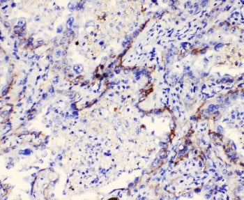Integrin alpha 3 Antibody / ITGA3