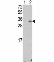 Western blot analysis of VEGFB antibody and 293 cell lysate (2 ug/lane) either nontransfected (Lane 