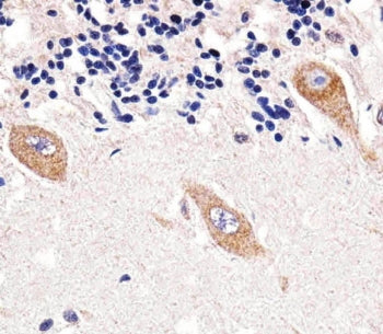 TENT2 Antibody / GLD2