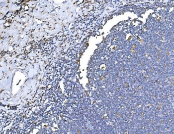 IHC staining of FFPE human tonsil tissue with HO-1 antibody. HIER: boil tissue sections in pH8 EDTA 