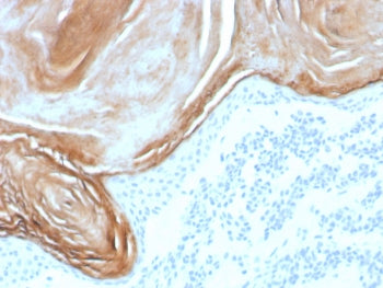 IHC staining of FFPE human skin tissue with recombinant Kallikrein 7 antibody (clone KLK7/8971R). HI