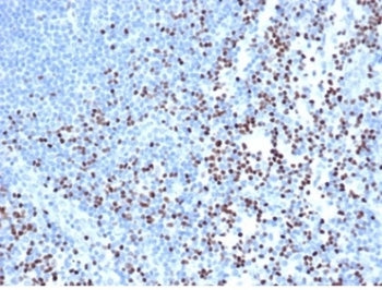 LEF1 Antibody / Lymphoid enhancer-binding factor 1 / TCF1 alpha