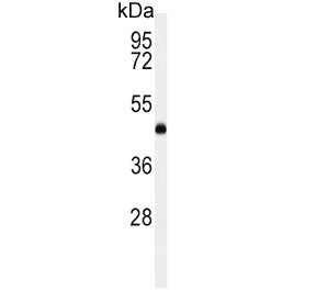 LCAT Antibody