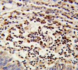 Mitochondrial amidoxime reducing component 2 Antibody / mARC2 / MTARC2