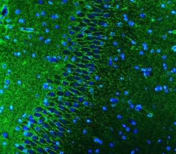 Immunofluorescent staining of FFPE rat brain tissue with EAAT1 antibody (green) and DAPI nuclear sta