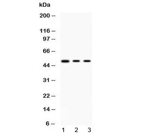 Western blot testing of 1) rat thymus, 2) human HepG2 and 3) human MCF7 lysate with PRKAR1A antibody