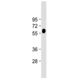 GGT3P Antibody (Center Region)